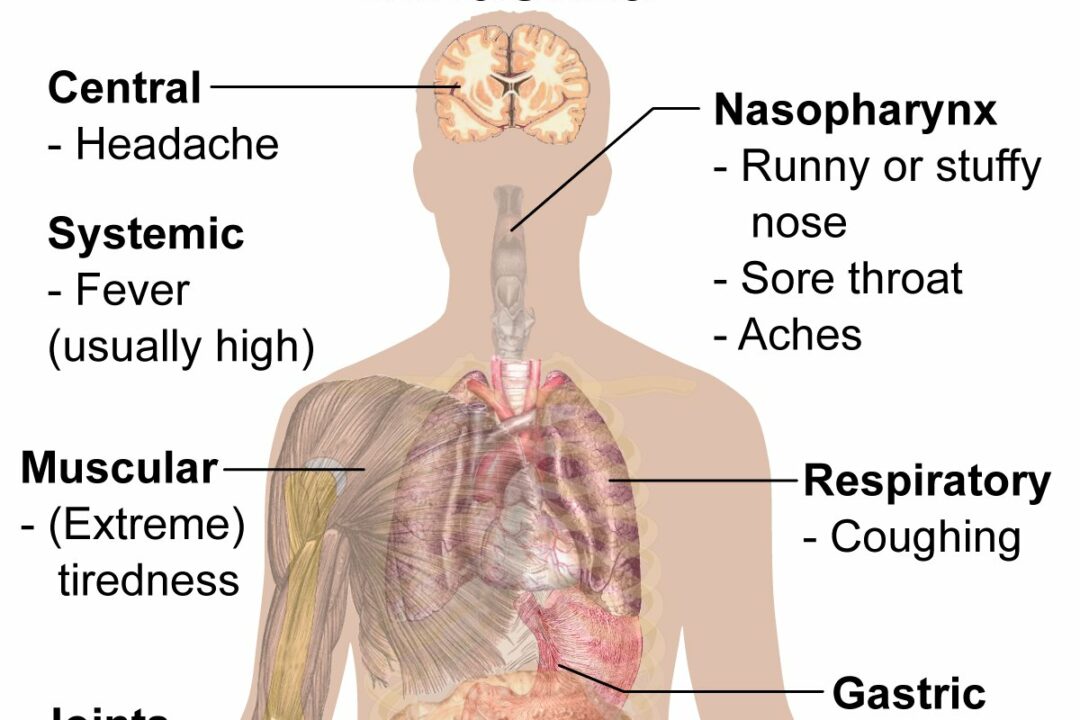 Symptoms of influenza