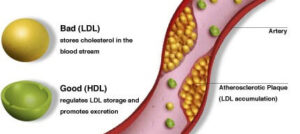 cholesterol screening specialist blood flow