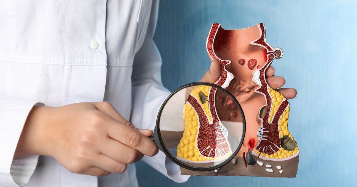 do oral glp 1 medications work Pills vs. Pens: The Ultimate Comparison of Oral and Injectable GLP-1s