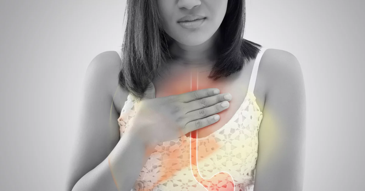Acid Reflux/Heartburn
