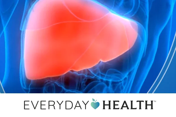 How Are Primary Sclerosing Cholangitis and Crohn’s Disease Linked?