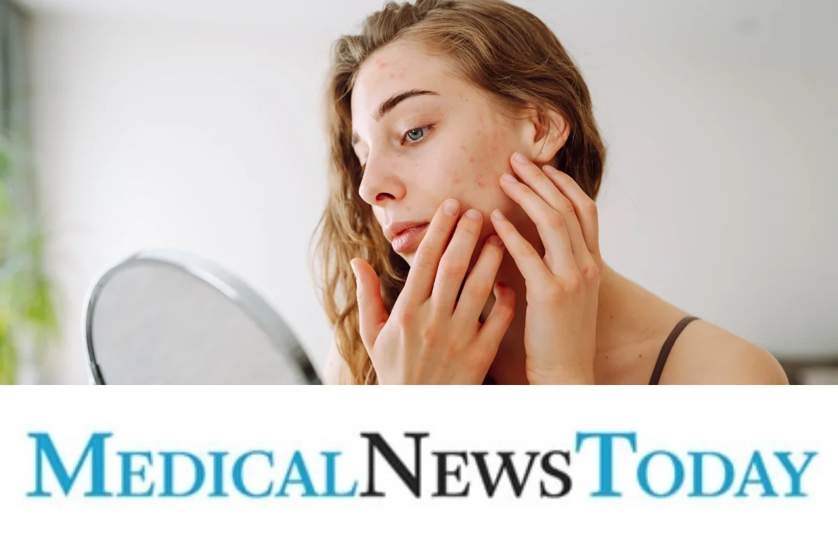 Supplements that support gut health may also benefit skin health