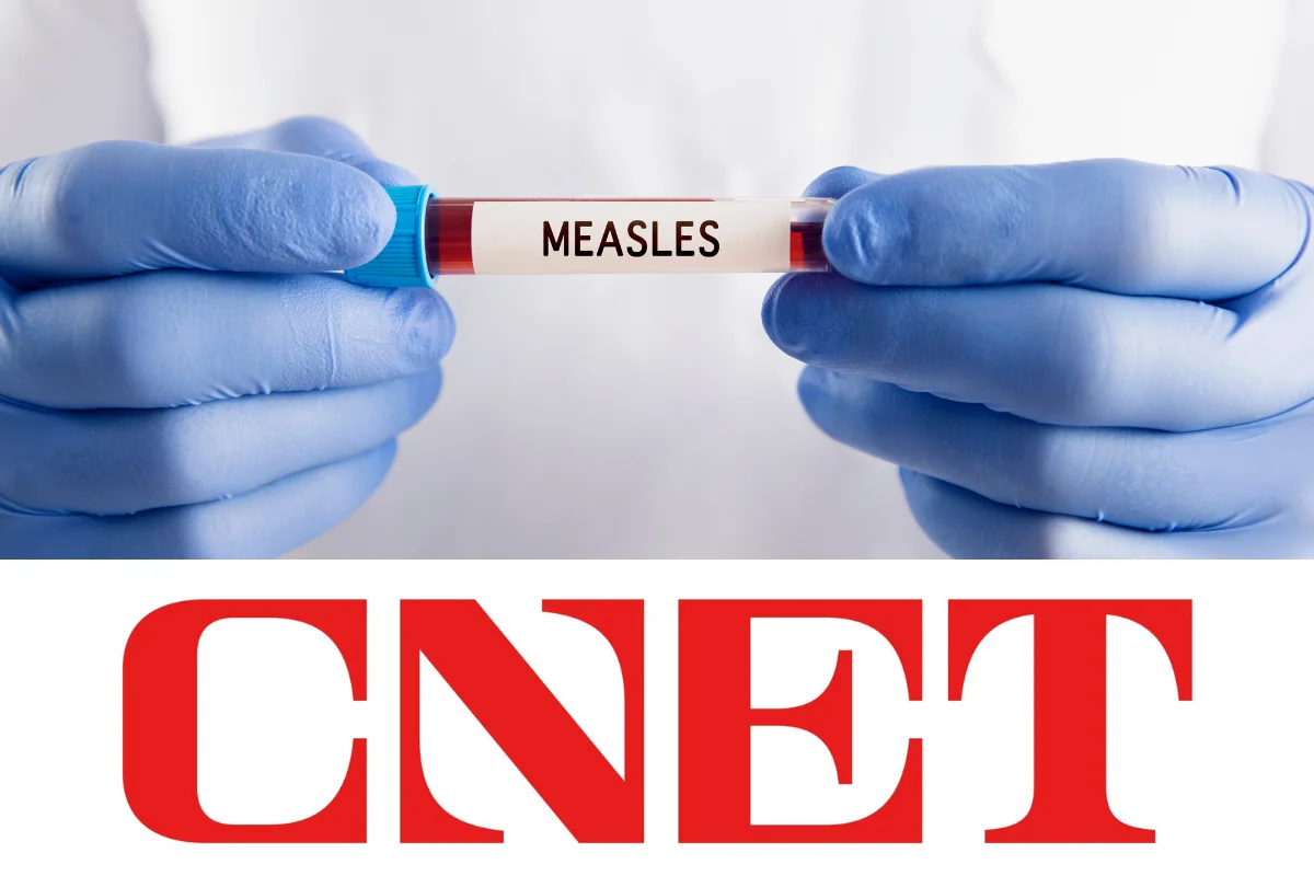Measles Cases Soar in South Carolina. Do You Need a Measles Booster?