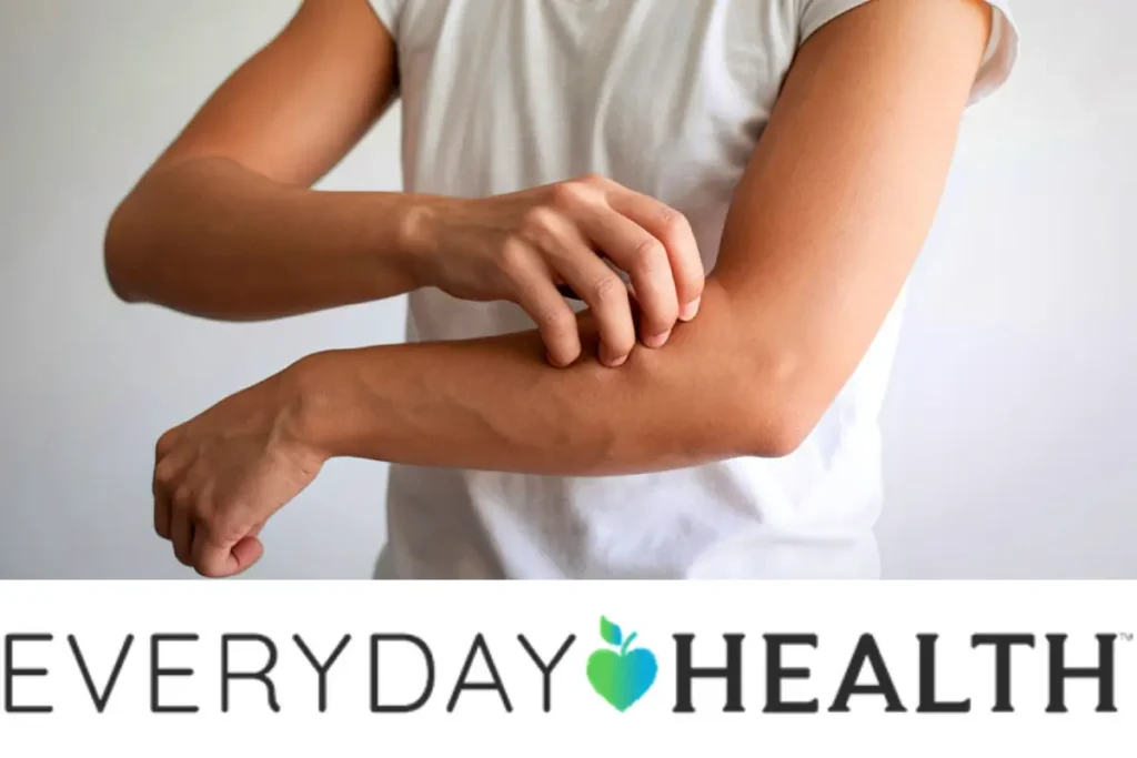 Breaking the ‘Flare-Fix’ Cycle: Why Your Current Atopic Dermatitis Routine Might Be Holding You Back