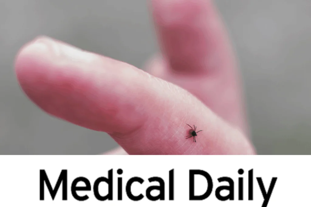 Tick Bite ER Visits Are Up 25% as CDC Warns Lyme Disease Season Is Intensifying
